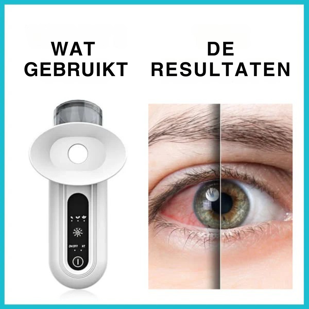 EyeSoothe™ | Warmte‑stoom therapie voor rustgevende ogen